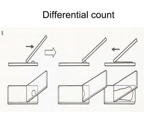 Differential count
 