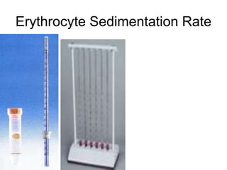 Erythrocyte Sedimentation Rate
 