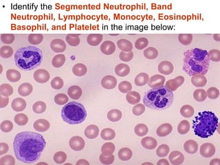 • Identify the Segmented Neutrophil, Band
Neutrophil, Lymphocyte, Monocyte, Eosinophil,
Basophil, and Platelet in the image below:
 