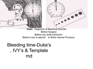 Bleeding time-Duke’s
, IVY’s & Template
md
Uses: Diagnosis of Bleeding Disorder.
Before Surgery.
Before any tooth extraction
Before Liver or pleural or Bone marrow Puncture
 