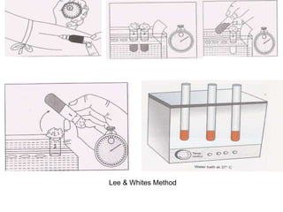 Lee & Whites Method
 