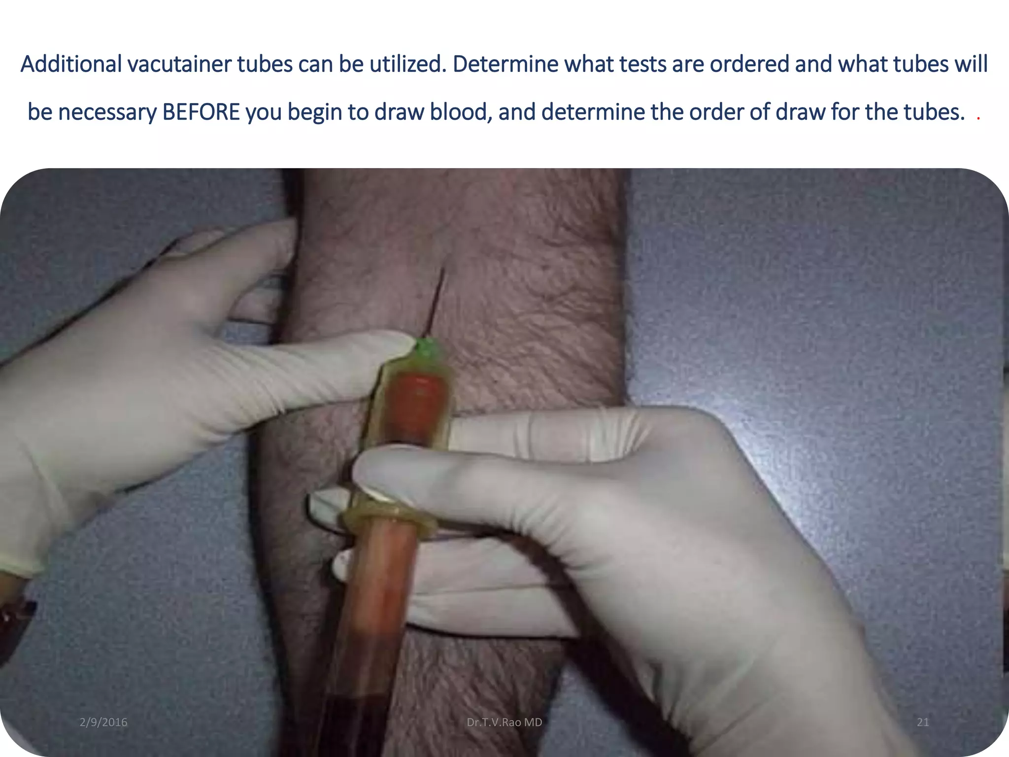 Additional vacutainer tubes can be utilized. Determine what tests are ordered and what tubes will
be necessary BEFORE you begin to draw blood, and determine the order of draw for the tubes. .
Dr.T.V.Rao MD 212/9/2016
 