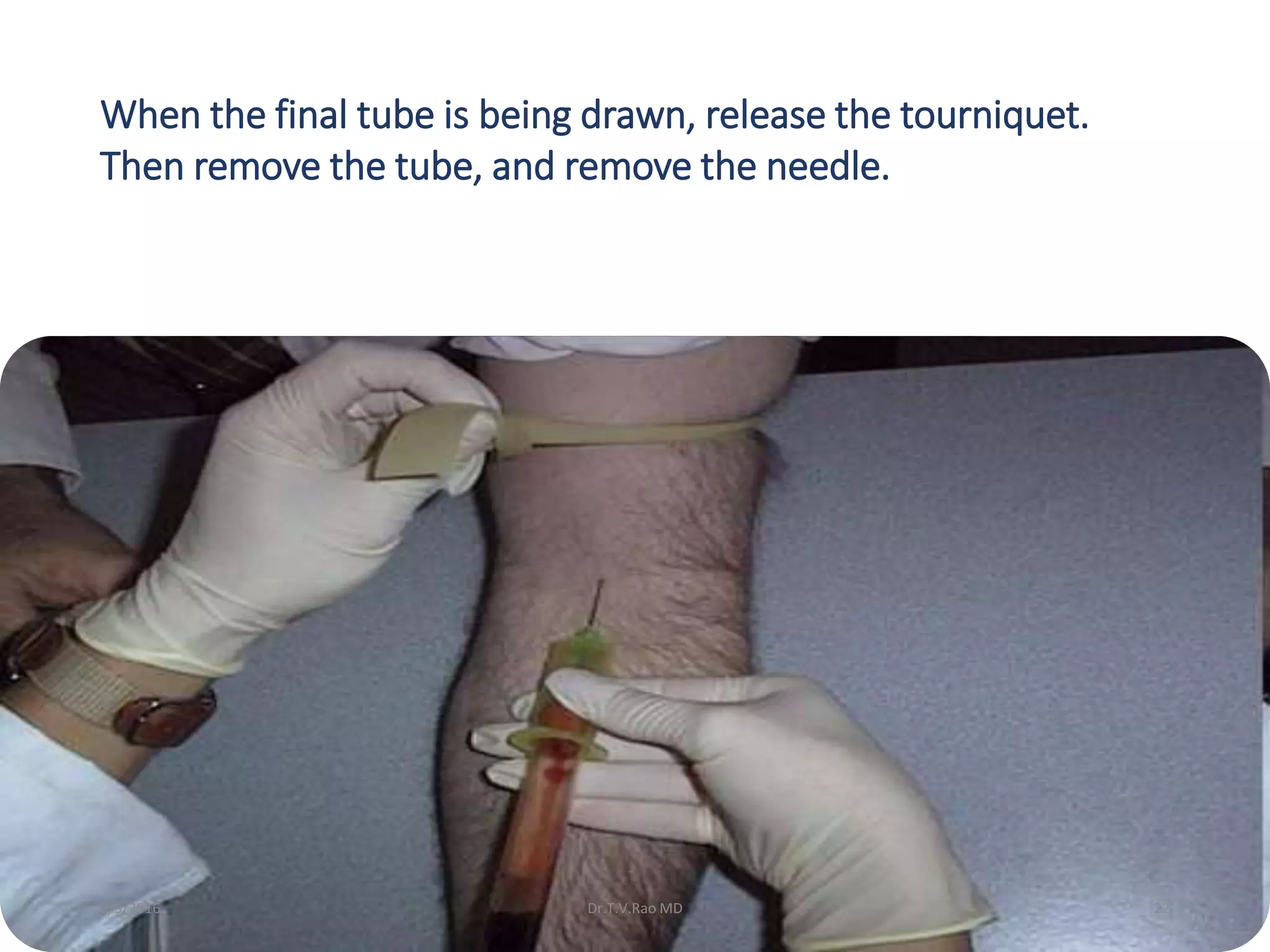 When the final tube is being drawn, release the tourniquet.
Then remove the tube, and remove the needle.
Dr.T.V.Rao MD 222/9/2016
 