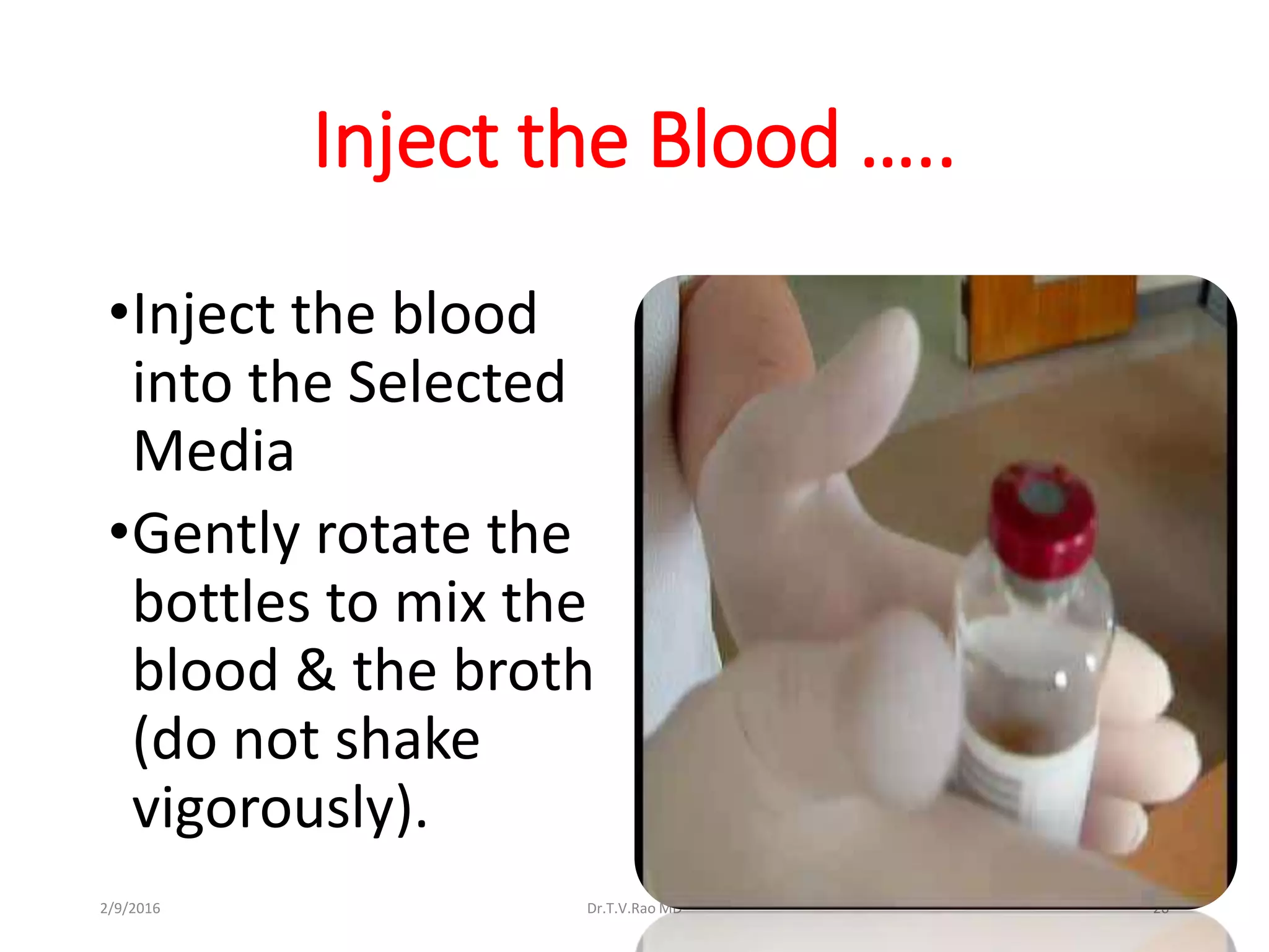 Inject the Blood …..
•Inject the blood
into the Selected
Media
•Gently rotate the
bottles to mix the
blood & the broth
(do not shake
vigorously).
Dr.T.V.Rao MD 262/9/2016
 