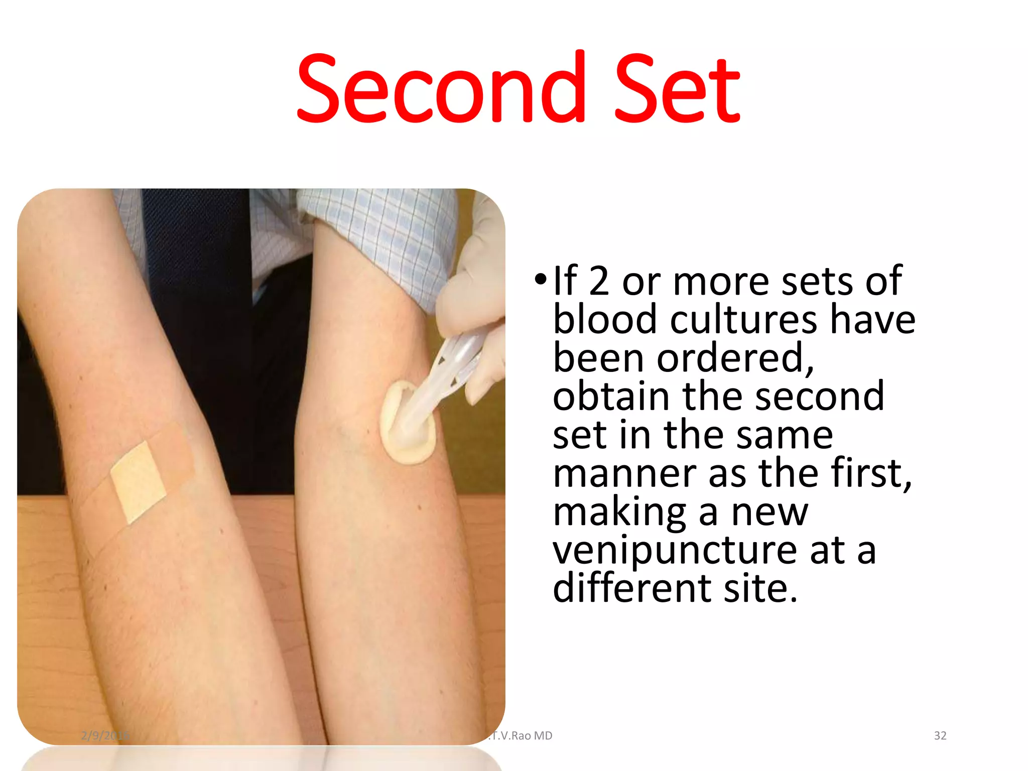 Second Set
•If 2 or more sets of
blood cultures have
been ordered,
obtain the second
set in the same
manner as the first,
making a new
venipuncture at a
different site.
Dr.T.V.Rao MD 322/9/2016
 