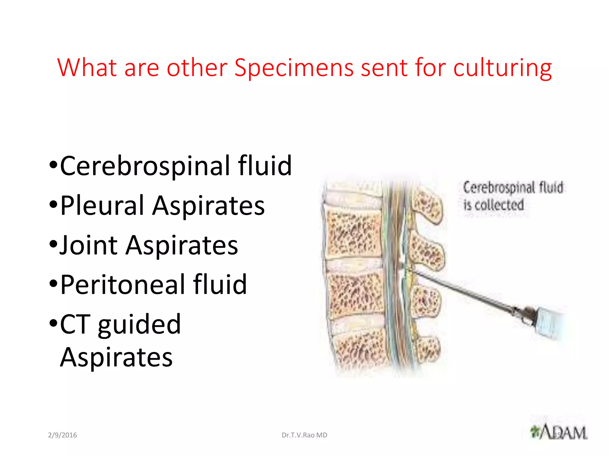 What are other Specimens sent for culturing
•Cerebrospinal fluid
•Pleural Aspirates
•Joint Aspirates
•Peritoneal fluid
•CT guided
Aspirates
Dr.T.V.Rao MD 452/9/2016
 
