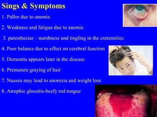 Sings & Symptoms
1. Pallor due to anemia
2. Weakness and fatigue due to anemia
3. paresthesias – numbness and tingling in the extremities
4. Poor balance due to effect on cerebral function
5. Dementia appears later in the disease
6. Premature graying of hair
7. Nausea may lead to anorexia and weight loss
8. Atrophic glossitis-beefy red tongue
 