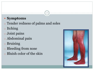 17
 Symptoms
o Tender redness of palms and soles
o Itching
o Joint pains
o Abdominal pain
o Bruising
o Bleeding from nose
o Bluish color of the skin
 