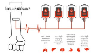 ระยะที่ 1 : ก้อนเนื้อ
หรือ แผลมะเร็งมี
ขนาดเล็ก และยังไม่
ลุกลาม
ระยะที่ 2 : ก้อนเนื้อ
หรือ แผลมะเร็งมี
ขนาดใหญ่ขึ้น เริ่ม
ลุกลามภายในเนื้อเยื่อ
หรืออวัยวะ
ระยะที่ 3 : ก้อนเนื้อ หรือ
แผลมะเร็งมีขนาดใหญ่ขึ้น
เริ่มลุกลามเข้าเนื้อเยื่อ
หรืออวัยวะข้างเคียง และ
ลุกลามเข้าต่อมน้าเหลือง
ที่อยู่ใกล้เนื้อเยื่อหรือ
อวัยวะที่เป็นมะเร็ง
ระยะที่ 4 : ก้อนเนื้อ
หรือ แผลมะเร็งมี
ขนาดโตมาก และ
(หรือ) ลุกลามเข้า
เนื้อเยื่อหรืออวัยวะ
ข้างเคียง จนทะลุ
โรคมะเร็งมีกี่ระยะ?
 