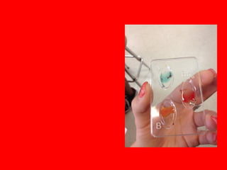 This picture shows
blood types A, B, and
Rh negative
 