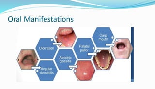 BLOOD DYSCRASIA [Autosaved].pptx