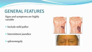 BLOOD DYSCRASIA [Autosaved].pptx