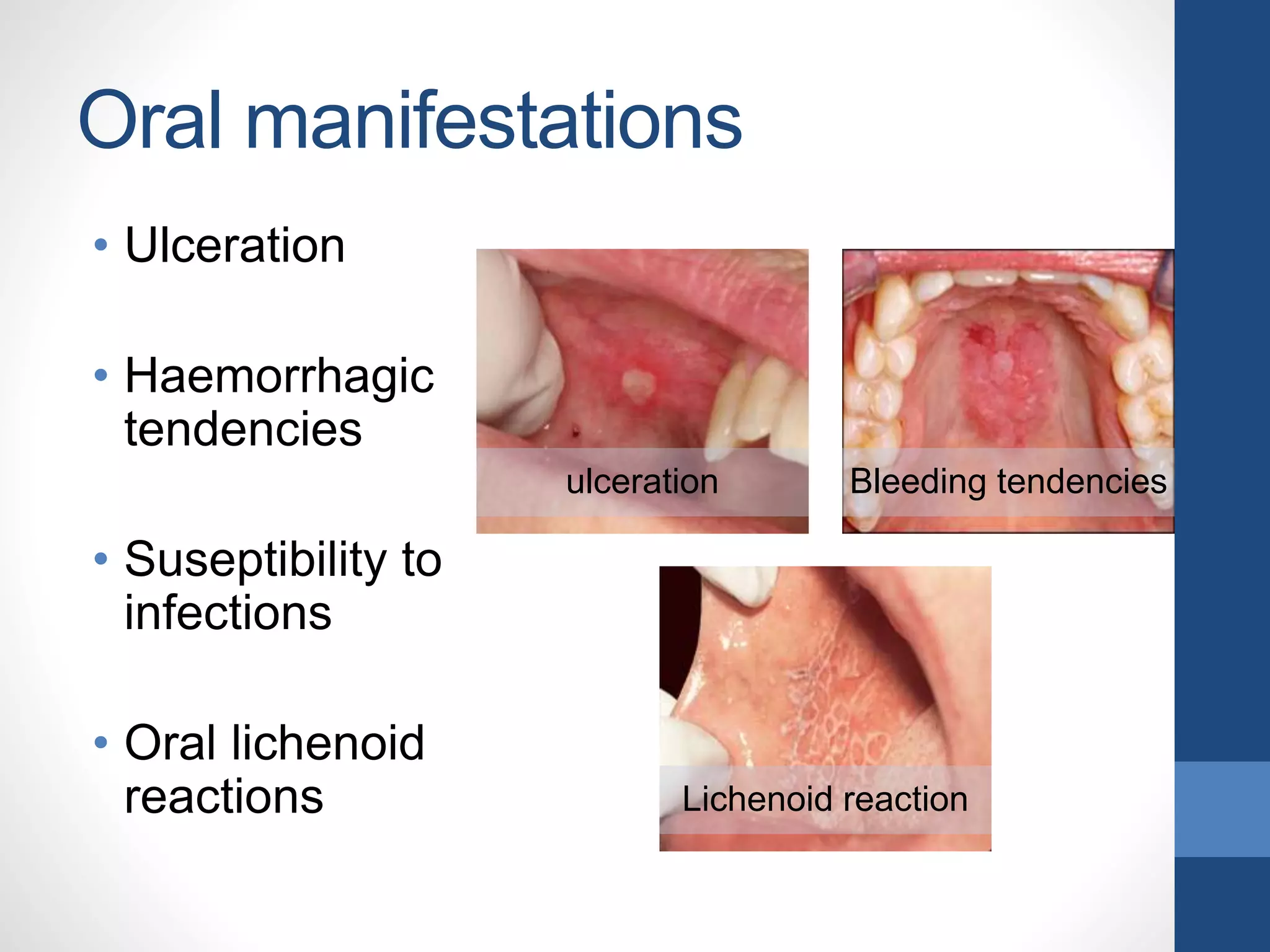 Dyscariasis Blood dyscrasias | PPTX
