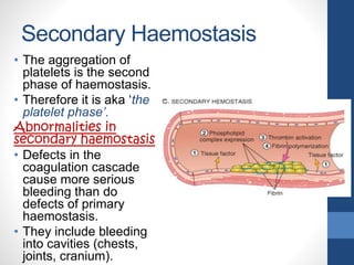 Secondary Haemostasis
• The aggregation of
platelets is the second
phase of haemostasis.
• Therefore it is aka ‘the
platelet phase’.
Abnormalities in
secondary haemostasis
• Defects in the
coagulation cascade
cause more serious
bleeding than do
defects of primary
haemostasis.
• They include bleeding
into cavities (chests,
joints, cranium).
 