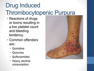 Drug Induced
Thrombocytopenic Purpura
• Reactions of drugs
or toxins resulting in
a low platelet count
and bleeding
tendency.
• Common offenders
are:
• Quinidine
• Quiunine
• Sulfonamides
• Heavy alcohol
consumption.
 
