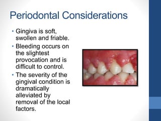 Periodontal Considerations
• Gingiva is soft,
swollen and friable.
• Bleeding occurs on
the slightest
provocation and is
difficult to control.
• The severity of the
gingival condition is
dramatically
alleviated by
removal of the local
factors.
 