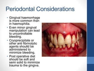 Periodontal Considerations
• Gingival haemorrhage
is more common than
in haemophilia.
• Even minor gingival
manipulation can lead
to uncontrollable
bleeding.
• Cryoprecipitate or
other anti fibrinolytic
agents shoulld be
administered to
minimize bleeding.
• Post operative diet
should be soft and
semi solid to minimize
trauma to the gingiva.
 