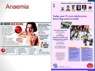 Anaemia
 