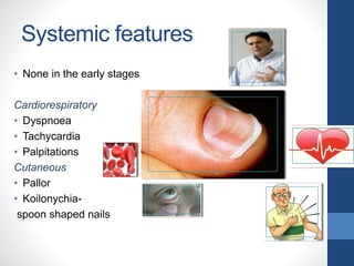 Systemic features
• None in the early stages
Cardiorespiratory
• Dyspnoea
• Tachycardia
• Palpitations
Cutaneous
• Pallor
• Koilonychia-
spoon shaped nails
 