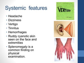 Systemic features
• Headache
• Dizziness
• Vertigo
• Tinnitus
• Hemorrhages
• Ruddy cyanotic skin
seen on the face and
extremities
• Splenomegaly is a
common finding on
physical
examination.
 