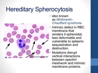 Hereditary Spherocytosis
• also known
as Minkowski–
Chauffard syndrome
• Intrinsic defect in RBC
membrane that
renders it spheroidal,
less deformable and
vulnerable to spleenic
sequestration and
destruction.
• Mutations disrupt
vertical interactions
between spectrin
meshwork and intrinsic
membrane proteins.
 