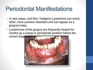 Periodontal Manifestations
• In rare cases, oral Non- Hodgkins Lymphoma can mimic
other, more common disorders and can appear as a
gingival mass.
• Lymphomas of the gingiva are frequently treated for
months as a pulpal or periodontal problem before the
correct diagnosis is made.
 