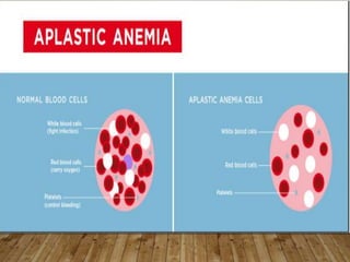 Dyscariasis Blood dyscrasias | PPTX