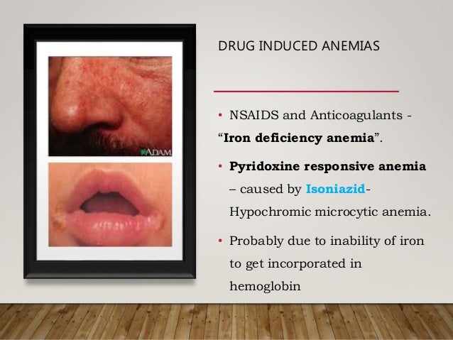 Dyscariasis Dyscrasias Definition : Blood Dyscrasia Diagnosis and Treatment – CTGV