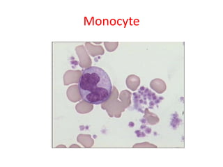 Monocyte
 