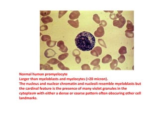 Normal human promyelocyte
Larger than myeloblasts and myelocytes (>20 micron).
The nucleus and nuclear chromatin and nucleoli resemble myeloblasts but
the cardinal feature is the presence of many violet granules in the
cytoplasm with either a dense or coarse pattern often obscuring other cell
landmarks.
 