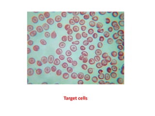 t
Target cells
 