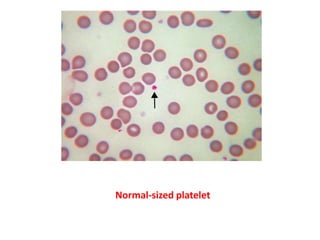 Normal-sized platelet
 