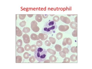 Segmented neutrophil
 