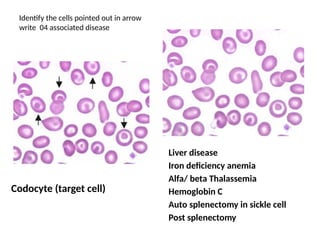Codocyte Drawing BLOOD film for study of pediatrics , md part 1 | PPTX