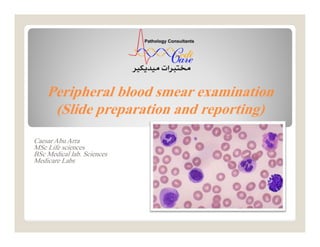 Peripheral blood smear examination
(Slide preparation and reporting)
Caesar Abu Arra
MSc Life sciences
BSc Medical lab. Sciences
Medicare Labs
 