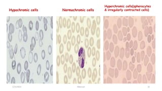 Hyperchromic Definition BLOOD FILM COMMENT part one.pptx