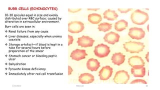 BLOOD FILM COMMENT part one.pptx