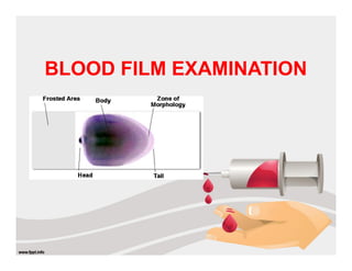 BLOOD FILM EXAMINATION
 