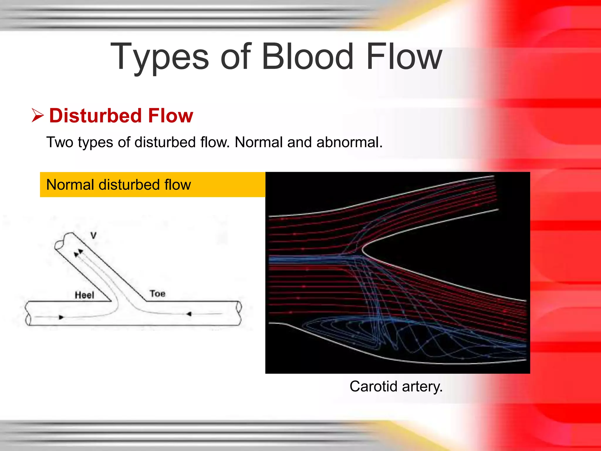 Types of Blood Flow
 Disturbed Flow
Two types of disturbed flow. Normal and abnormal.
Normal disturbed flow

Carotid artery.

 