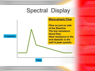 Spectral Display
Mono-phasic Flow
Flow on just on side
of the Baseline.
The low resistance
blood flow.
Ideal resistance is the
end diastolic is the
half of peak systolic.

Frequency

Time

 
