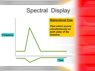 Spectral Display
Bidirectional Flow

Frequency

Flow which occurs
simultaneously on
both sides of the
baseline.

Time

 