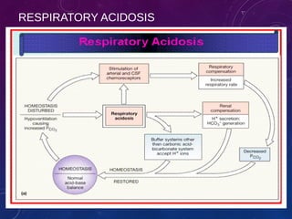 RESPIRATORY ACIDOSIS 
ABG 2013 
 