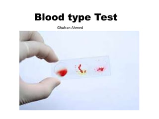 Blood type Test
Ghufran Ahmed
 