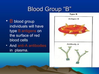 Blood Group “B”
• B blood group
  individuals will have
  type B antigens on
  the surface of red
  blood cells
• And anti-A antibodies
  in plasma.
 