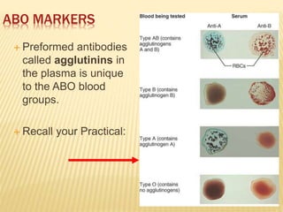 14
ABO MARKERS
 Preformed antibodies
called agglutinins in
the plasma is unique
to the ABO blood
groups.
 Recall your Practical:
 