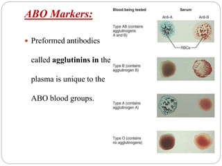 ABO Markers:
 Preformed antibodies
called agglutinins in the
plasma is unique to the
ABO blood groups.
 
