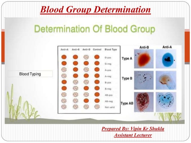 Blood group determination | PPT