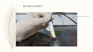 BLOOD SAMPLE
 