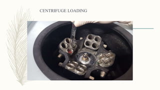 CENTRIFUGE LOADING
 