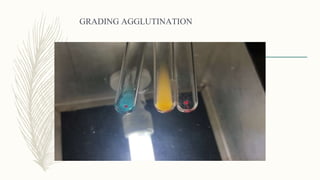 GRADING AGGLUTINATION
 